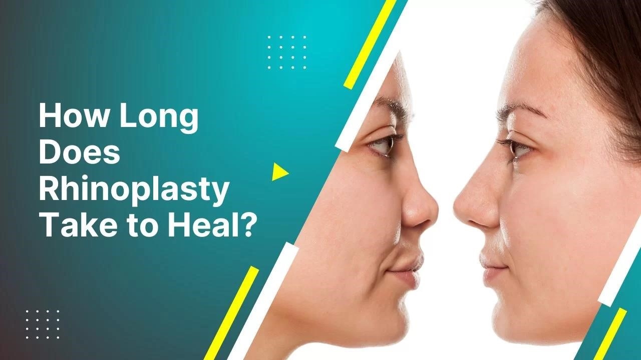 open vs closed rhinoplasty